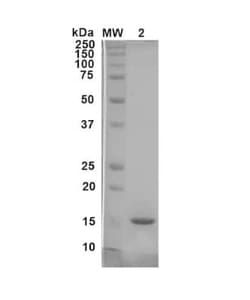Novus Biologicals Recombinant Mouse gamma-Synuclein Active, Monomer Protein 2 x 100 &mu;g Vials | Buy Online | Novus Biologicals | Fisher Scientific